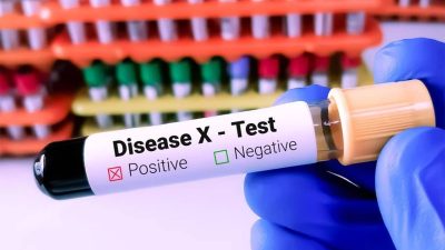 Terkait Isu Disease X Bakal Jadi Pandemi, Ini Penjelasan Kominfo